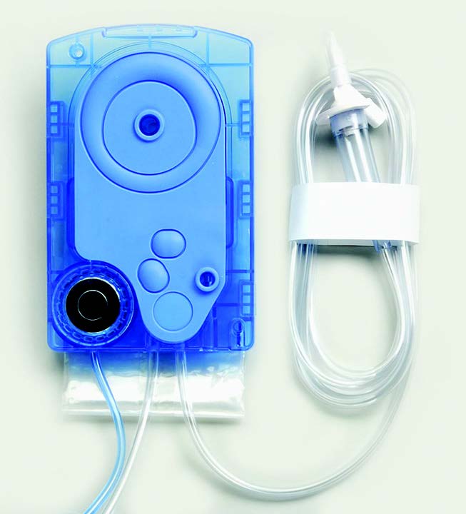 FLUID MANAGEMENT SYSTEM